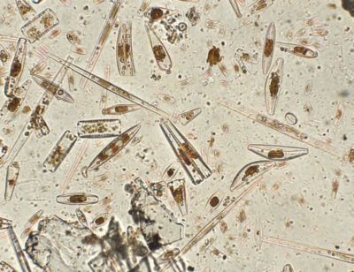 Diatomées aquarium au microscope