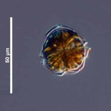Dinoflagellés du genre Alexandrium