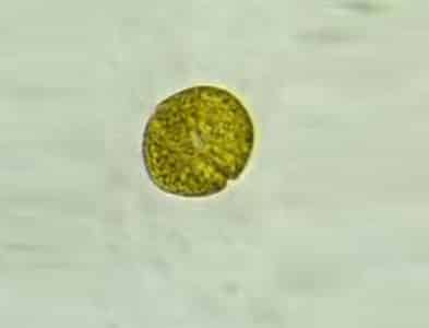 Dinoflagellés du genre gymnodinium