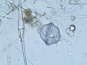 Dinoflagelles au microscope