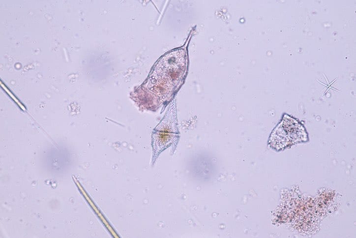 Cératium Dinoflagellé Protozoaires sous microscope.