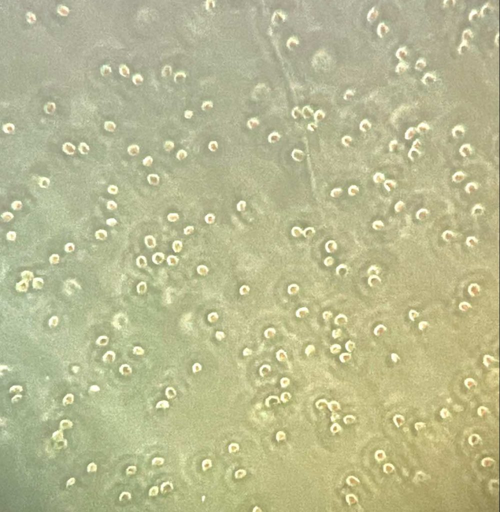 phytoplancton au microscope