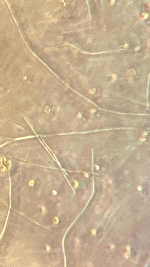 phytoplancton marin Synechococcus SP